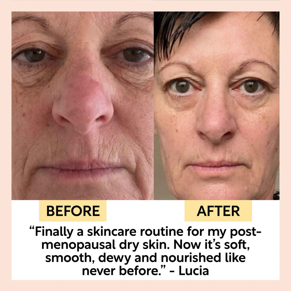 Eye Cream with Hyaluronic Acid &amp; Coffee