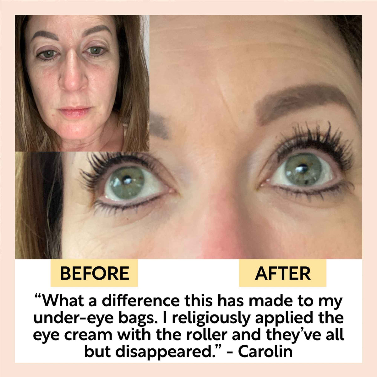 Eye Cream with Hyaluronic Acid &amp; Coffee